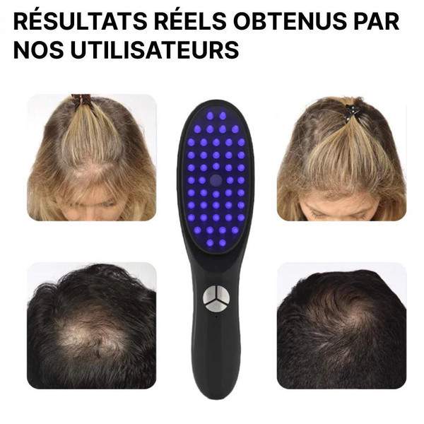 Brosse Laser EMS Anti-chute De Cheveux